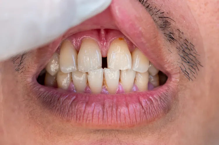 A guy with dental spacing