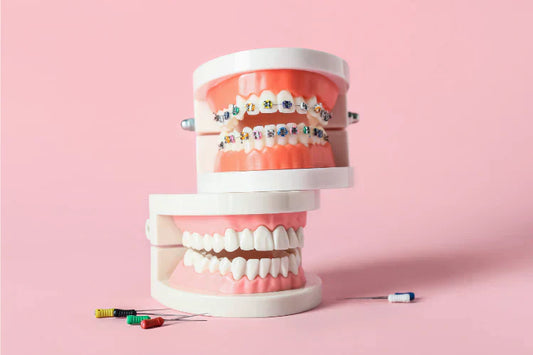 An image of dental models with and without fake braces