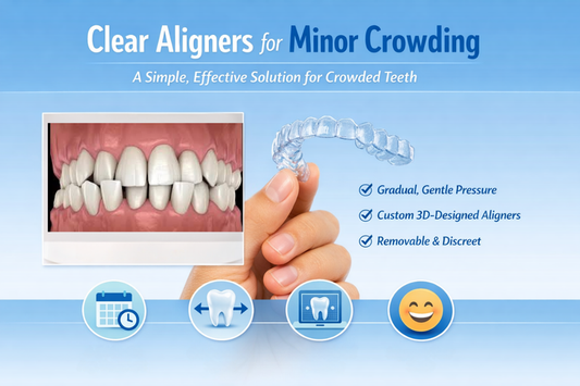 showing clear aligners for minor crowding, before view, and step-by-step alignment process over months