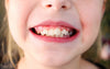 The Ultimate Guide to Teeth Straightening for Children and Teens: What You Need to Know