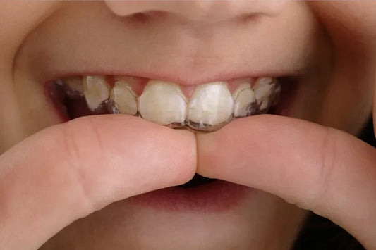A girl applying clear retainers.