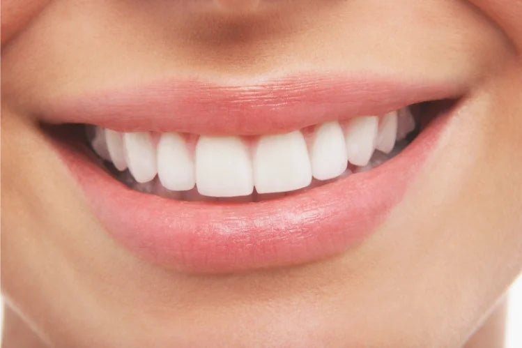 A person smiling to show perfect teeth alignment