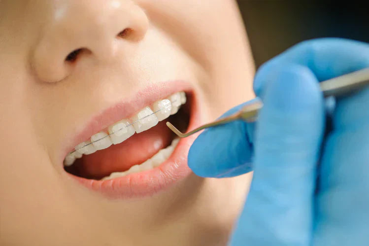 An image of a woman with ceramic braces in an orthodontist’s office