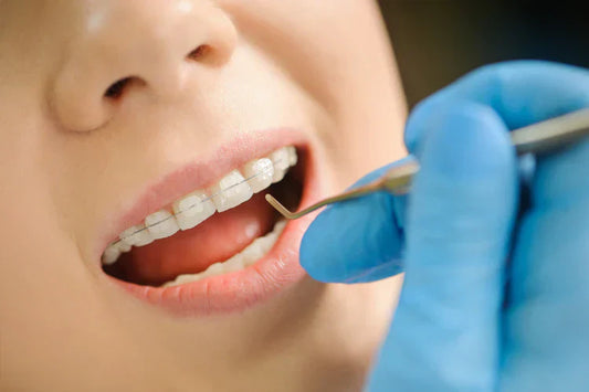 An image of a woman with ceramic braces in an orthodontist’s office