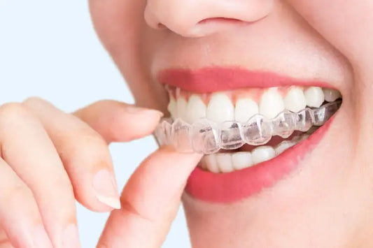 A close-up of a woman wearing clear aligners.