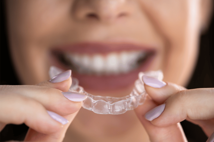 Clear Aligners Benefits