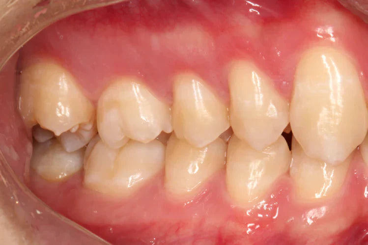 comprehensive-guide-to-posterior-teeth