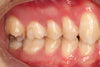 Comprehensive Guide to Posterior Teeth: Common Issues, Treatments & Care