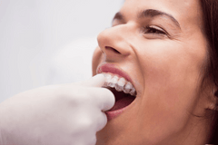 Effects of Tooth Decay on Teeth Straightening