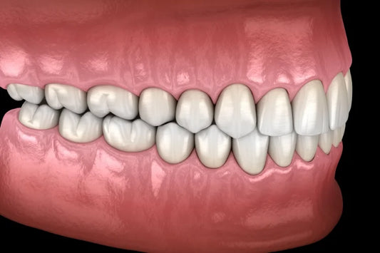 Human teeth with normal occlusion