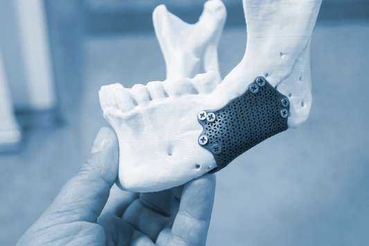 A person holding a dental model of a lower jaw