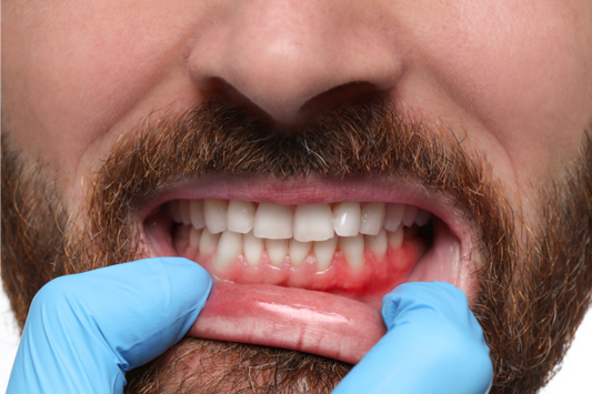 A person getting the condition of his gums checked before aligner treatment.