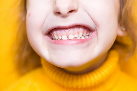  A close-up image of a child's overbite