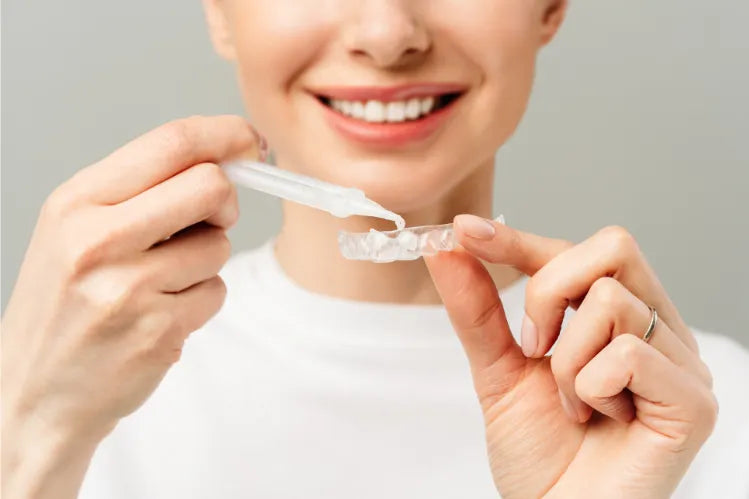  A woman applying teeth whitening gel to a custom teeth whitening tray 