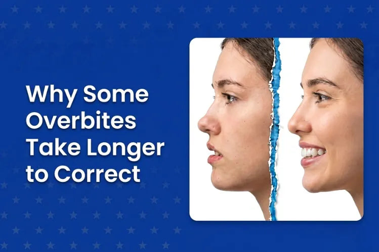 Side profile of a woman showing before-and-after progress in overbite correction using clear aligners.