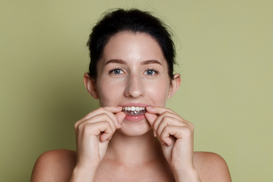 A girl applying clear aligners for teeth straightening.