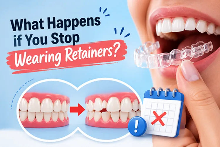 What Happens if You Stop Wearing Retainers after Braces? – Aligner32