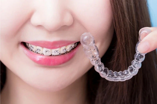 Clear Braces Near Me: How to Find the Right Provider