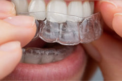 5 Myths About At-Home Teeth Straightening You Need to Stop Believing