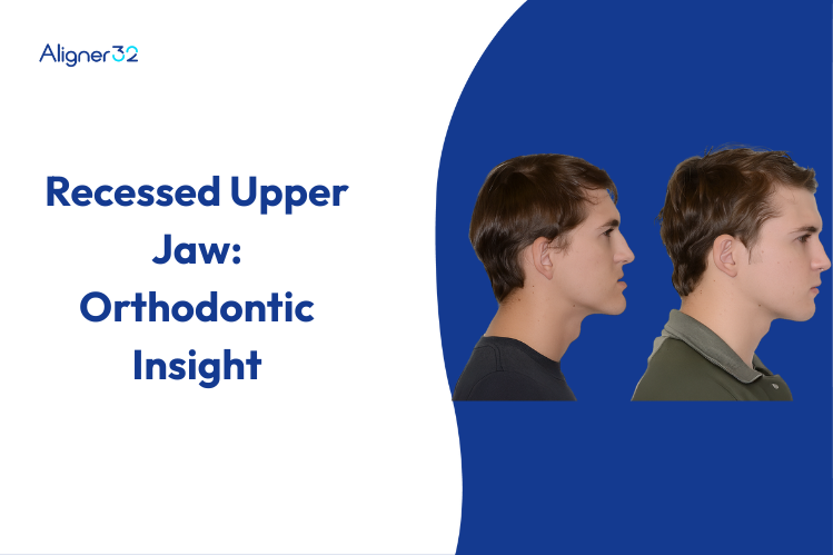 Recessed Upper Jaw: Orthodontic Insight