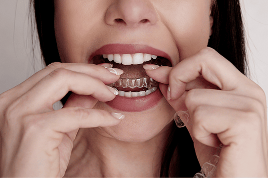 clear aligners.