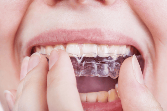 Invisible Aligners and Digestive Health