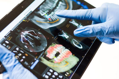 3D-scan