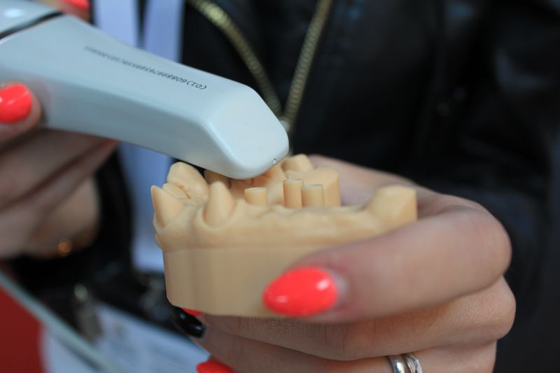 3D Scan Or Dental Impression At Aligner32